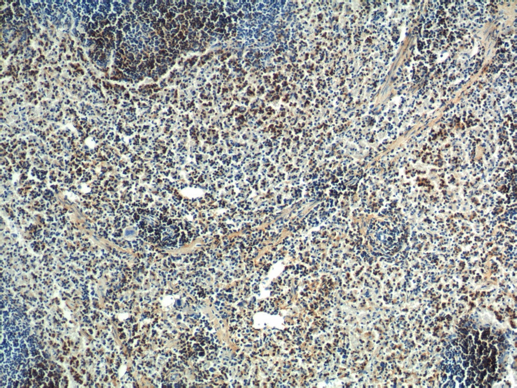 Immunohistochemistry (IHC) staining of mouse spleen tissue using PTPN5 Polyclonal antibody (14515-1-AP)