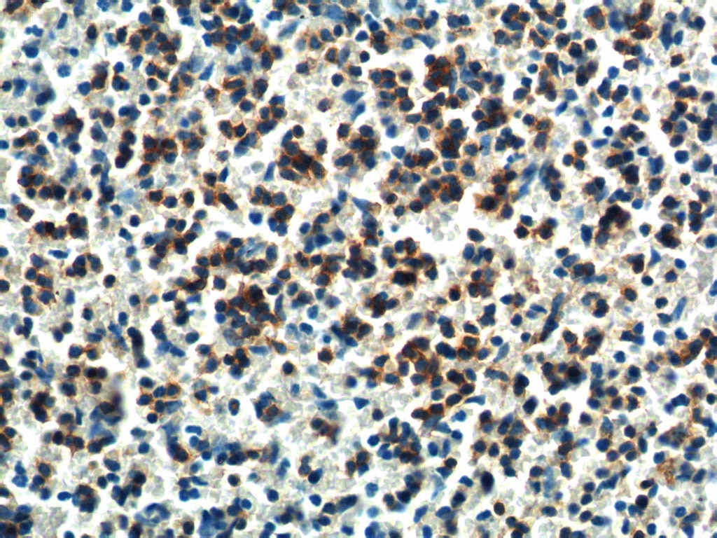 Immunohistochemistry (IHC) staining of mouse spleen tissue using PTPN5 Polyclonal antibody (14515-1-AP)