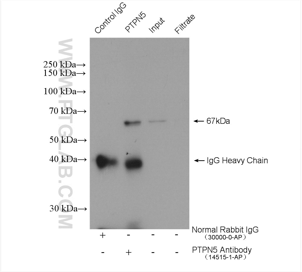 Immunoprecipitation (IP) experiment of mouse brain tissue using PTPN5 Polyclonal antibody (14515-1-AP)