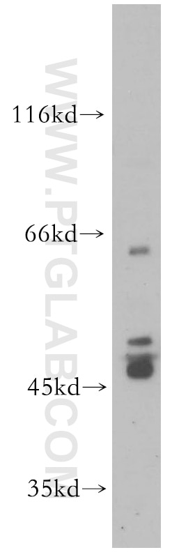 Western Blot (WB) analysis of HL-60 cells using PTPN5 Polyclonal antibody (14515-1-AP)
