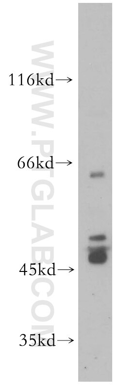 Western Blot (WB) analysis of HL-60 cells using PTPN5 Polyclonal antibody (14515-1-AP)