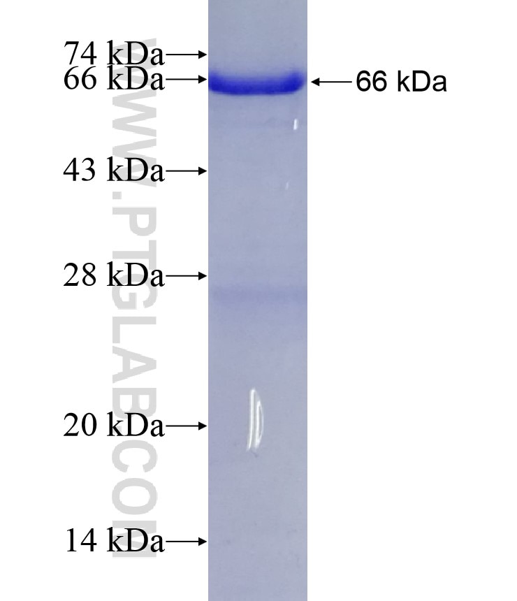 PTPN5 fusion protein Ag5974 SDS-PAGE
