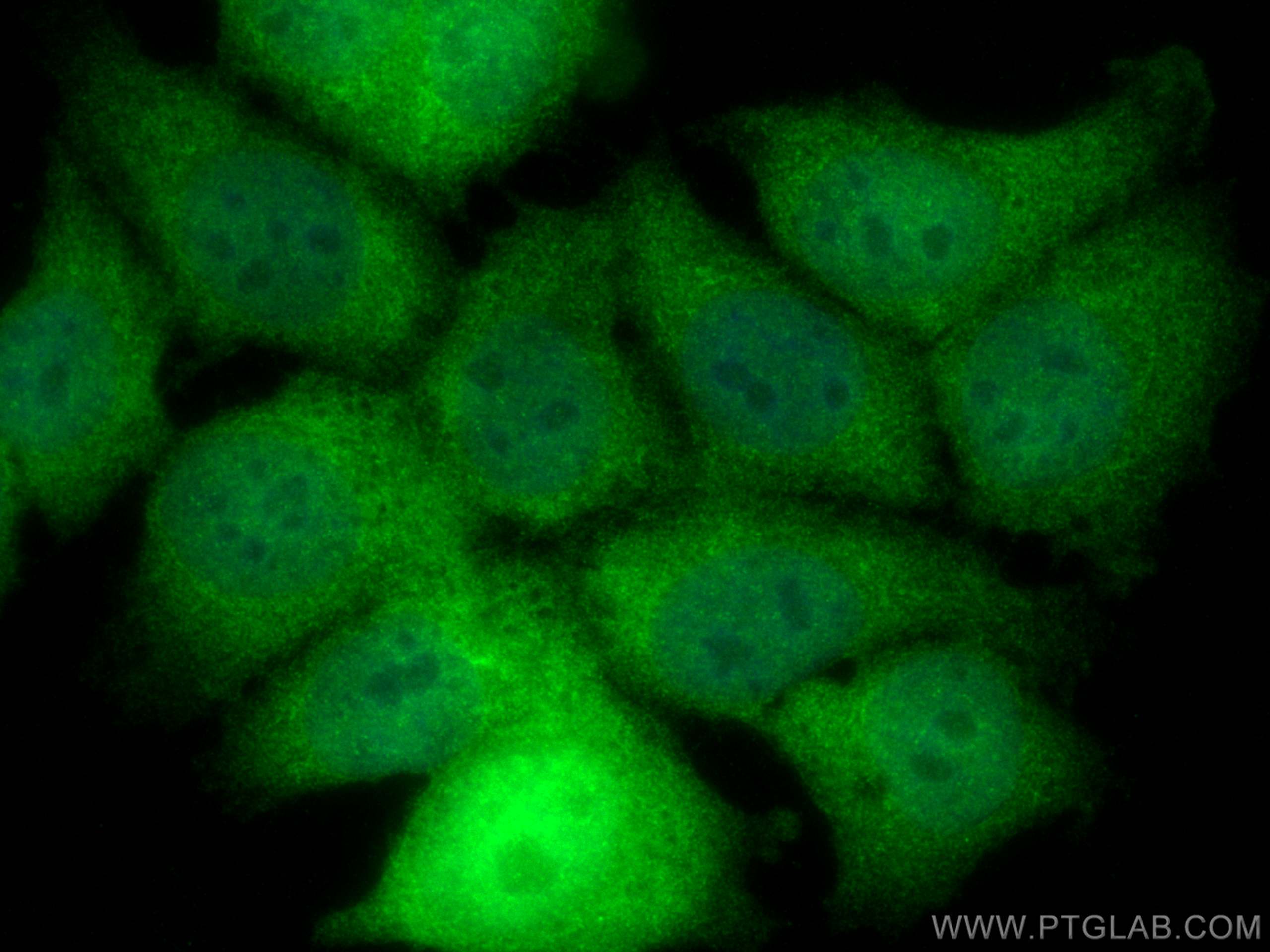 IF Staining of MCF-7 using 24546-1-AP