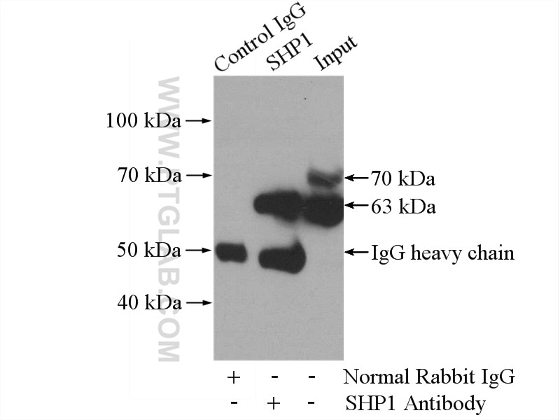 Immunoprecipitation (IP) experiment of Jurkat cells using PTPN6 Polyclonal antibody (24546-1-AP)