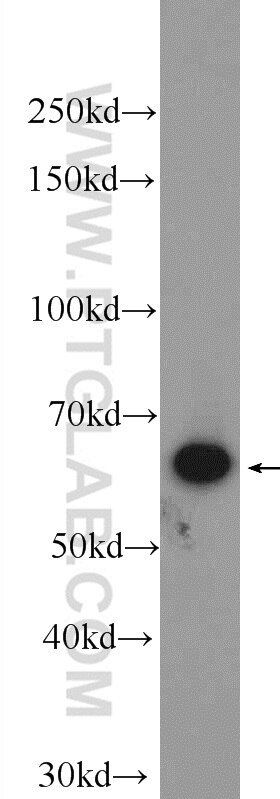 Western Blot (WB) analysis of Raji cells using PTPN6 Polyclonal antibody (24546-1-AP)