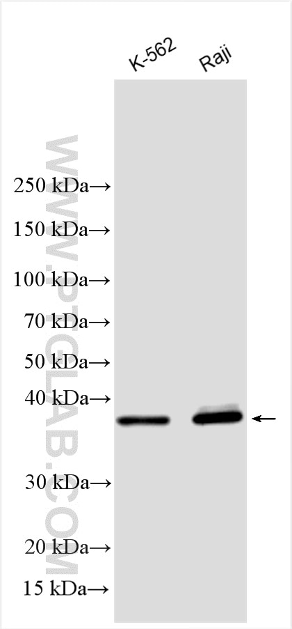 Western Blot (WB) analysis of various lysates using PTPN7 Polyclonal antibody (15286-1-AP)