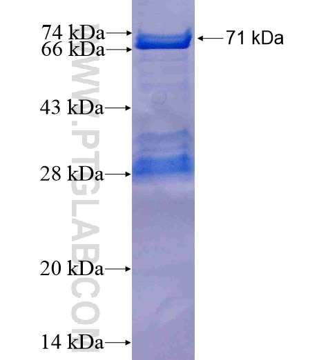 PTPN7 fusion protein Ag7453 SDS-PAGE