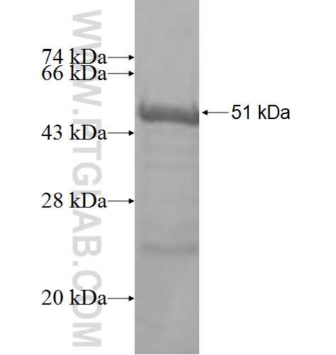 PTPN7 fusion protein Ag7469 SDS-PAGE