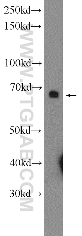 Western Blot (WB) analysis of mouse liver tissue using PTPN9 Polyclonal antibody (12109-1-AP)