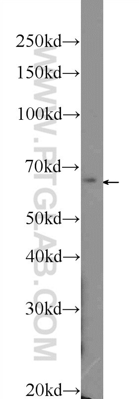 Western Blot (WB) analysis of mouse pancreas tissue using PTPN9 Polyclonal antibody (12109-1-AP)