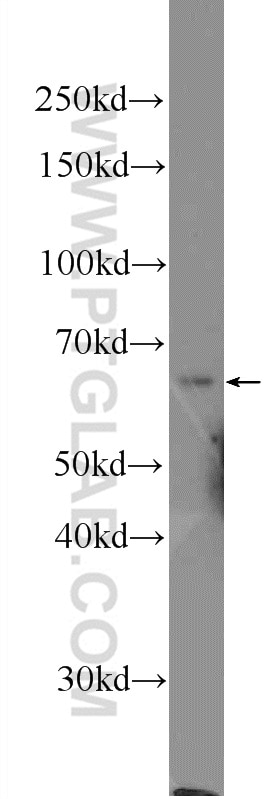 Western Blot (WB) analysis of A549 cells using PTPN9 Polyclonal antibody (12109-1-AP)