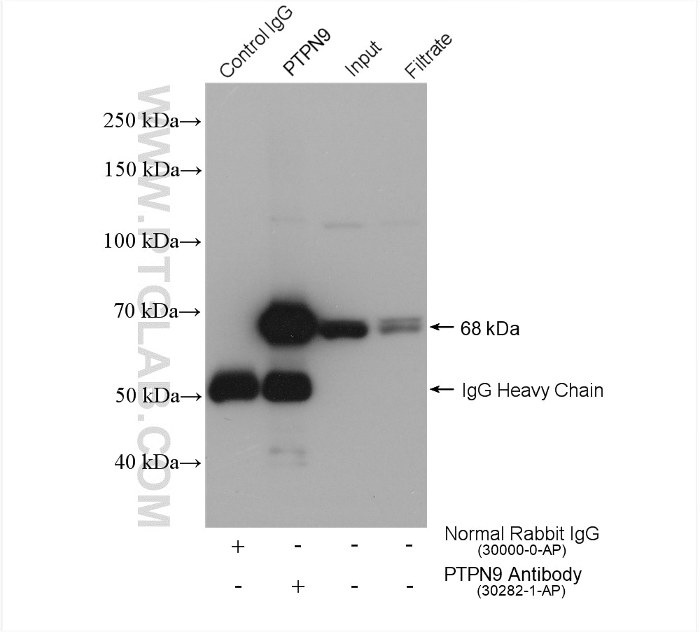 Immunoprecipitation (IP) experiment of HEK-293 cells using PTPN9 Polyclonal antibody (30282-1-AP)
