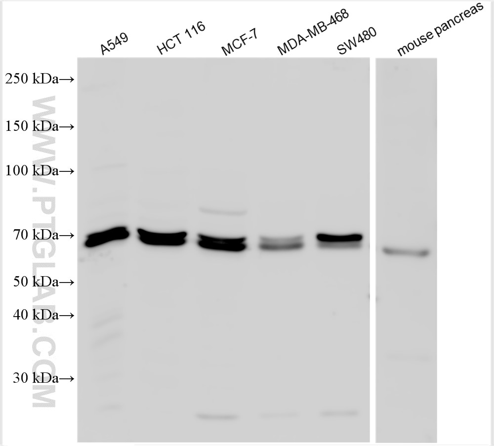 Western Blot (WB) analysis of various lysates using PTPN9 Polyclonal antibody (30282-1-AP)