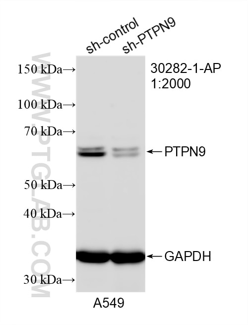 Western Blot (WB) analysis of A549 cells using PTPN9 Polyclonal antibody (30282-1-AP)