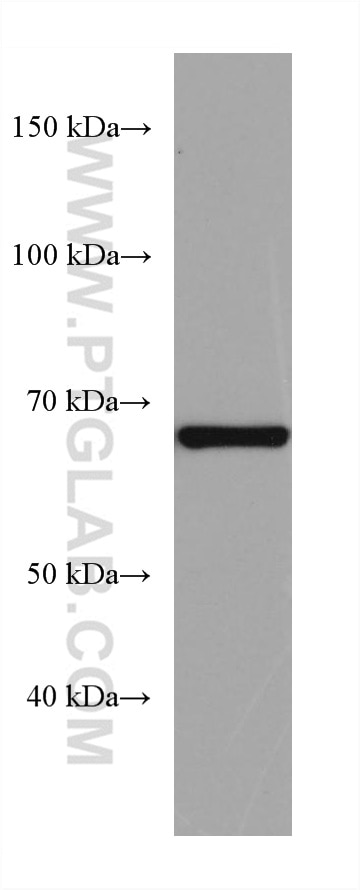 Western Blot (WB) analysis of pig pancreas tissue using PTPN9 Monoclonal antibody (67931-1-Ig)