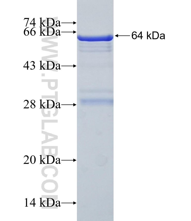 PTPN9 fusion protein Ag31971 SDS-PAGE