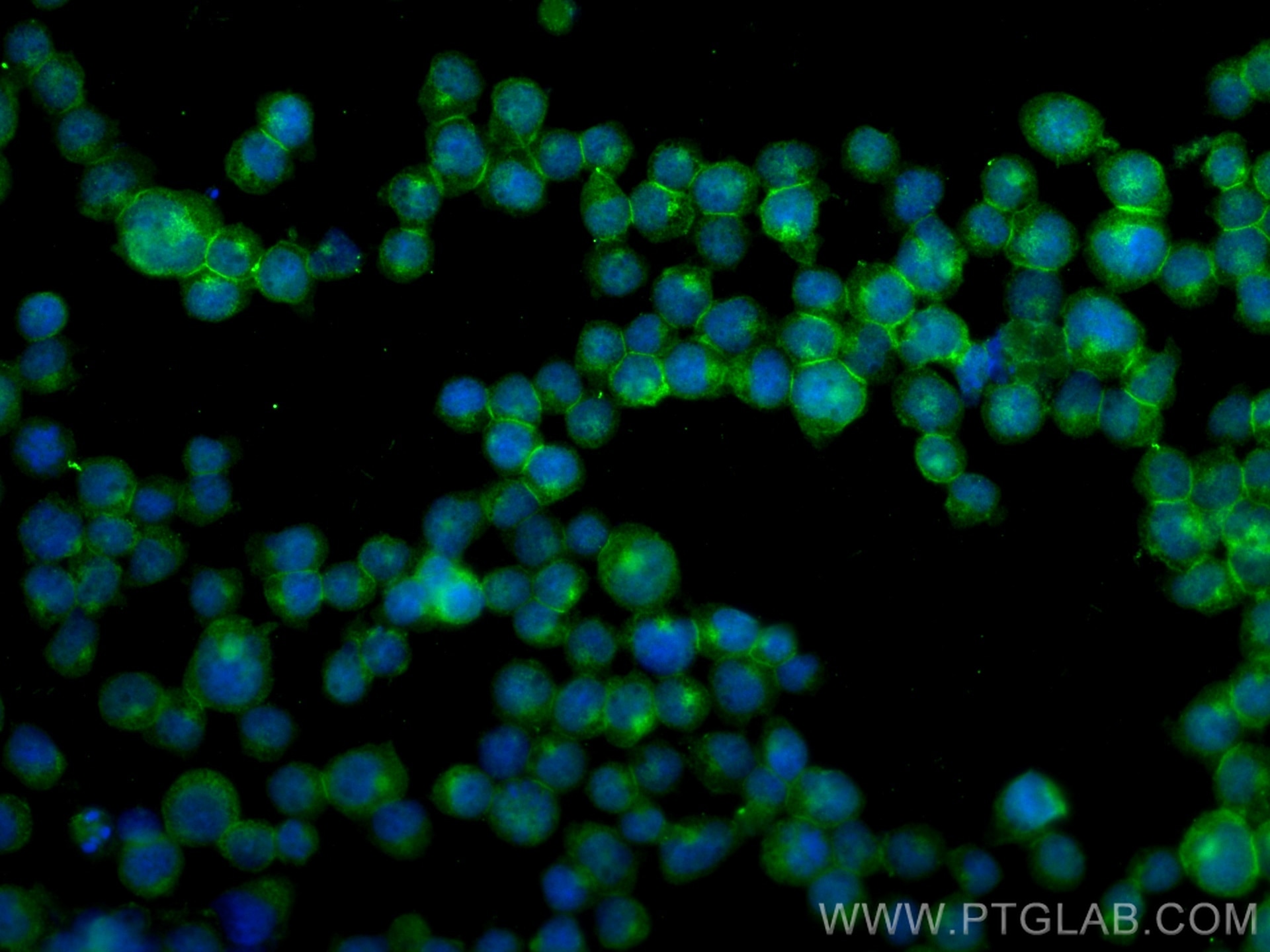 Immunofluorescence (IF) / fluorescent staining of Jurkat cells using PTPRCAP / CD45AP Polyclonal antibody (19715-1-AP)