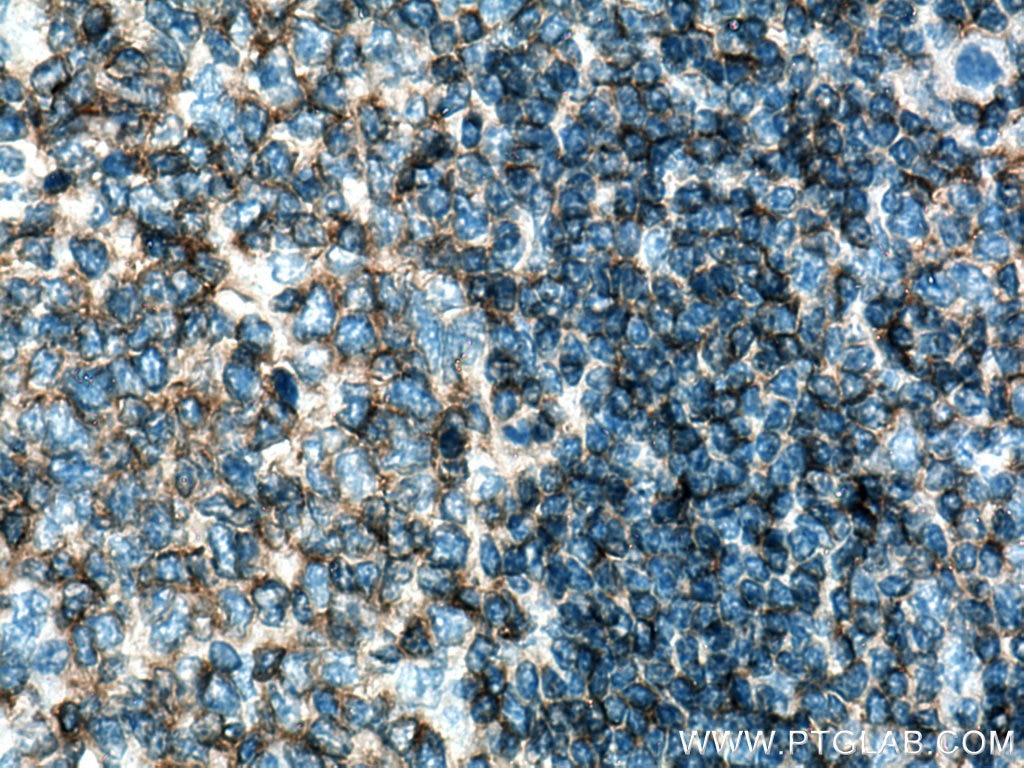 Immunohistochemistry (IHC) staining of human tonsillitis tissue using PTPRCAP / CD45AP Polyclonal antibody (19715-1-AP)