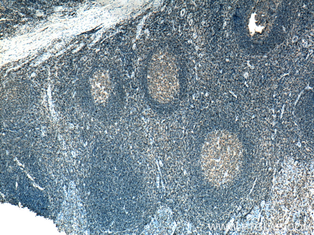 Immunohistochemistry (IHC) staining of human tonsillitis tissue using PTPRCAP / CD45AP Polyclonal antibody (19715-1-AP)