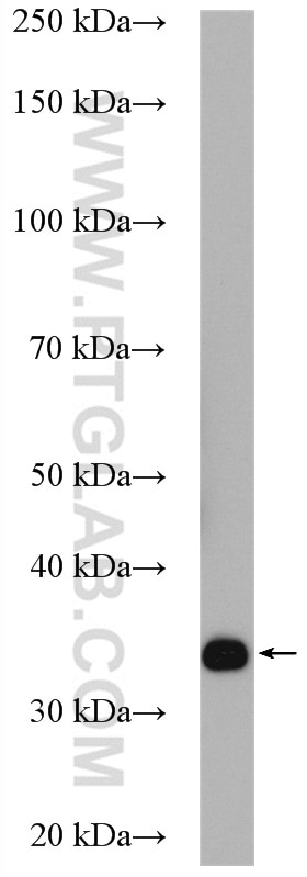 Western Blot (WB) analysis of Jurkat cells using PTPRCAP / CD45AP Polyclonal antibody (19715-1-AP)