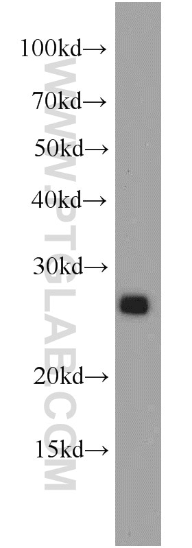 Western Blot (WB) analysis of Jurkat cells using PTPRCAP / CD45AP Polyclonal antibody (19715-1-AP)
