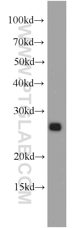WB analysis of Jurkat using 19715-1-AP