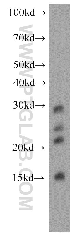 Western Blot (WB) analysis of human spleen tissue using PTPRCAP / CD45AP Polyclonal antibody (19715-1-AP)