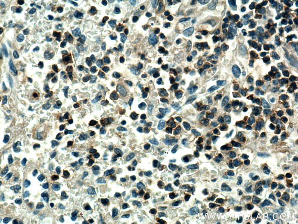 Immunohistochemistry (IHC) staining of human spleen tissue using PTPRCAP Polyclonal antibody (28286-1-AP)