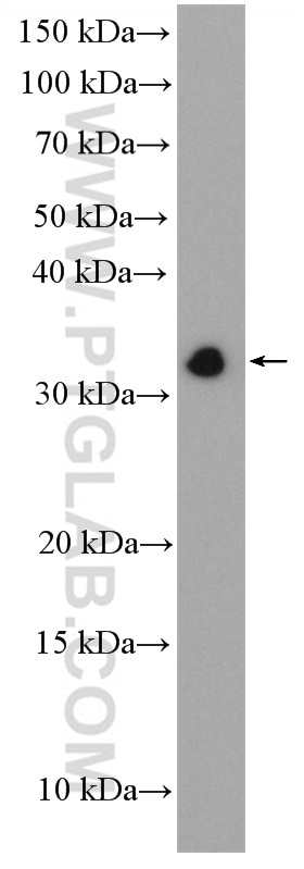 WB analysis of Jurkat using 28286-1-AP