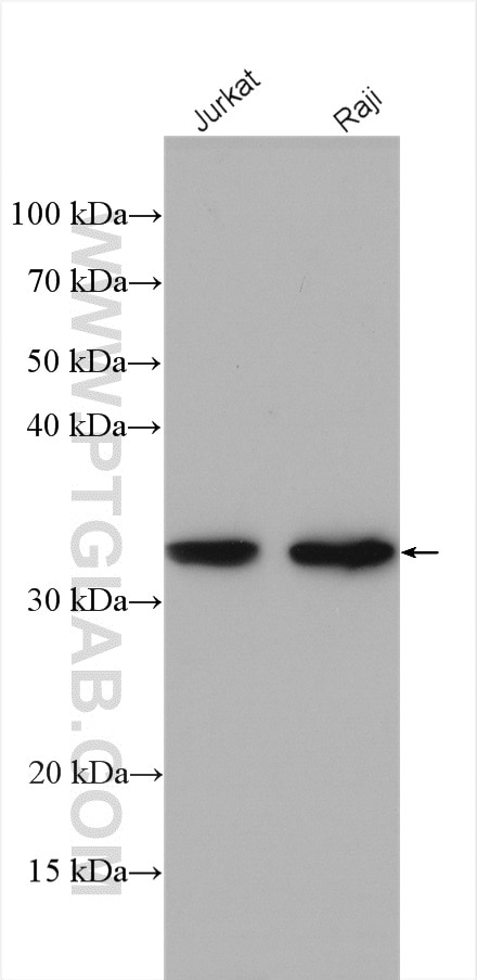 Western Blot (WB) analysis of various lysates using PTPRCAP Polyclonal antibody (28286-1-AP)