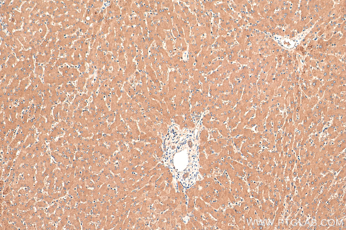 Immunohistochemistry (IHC) staining of human liver tissue using PTPRD Polyclonal antibody (27941-1-AP)