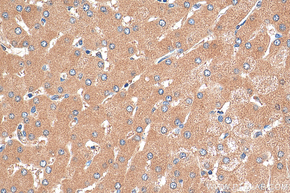 IHC staining of human liver using 27941-1-AP
