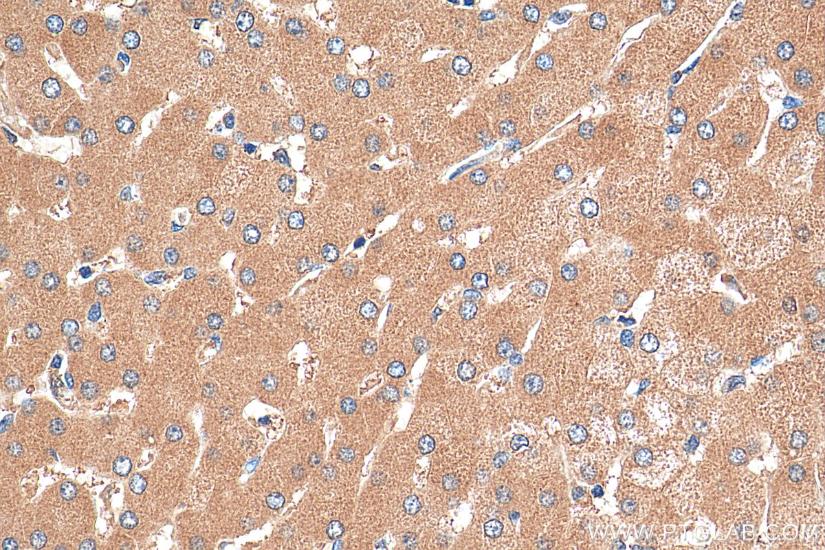 Immunohistochemistry (IHC) staining of human liver tissue using PTPRD Polyclonal antibody (27941-1-AP)