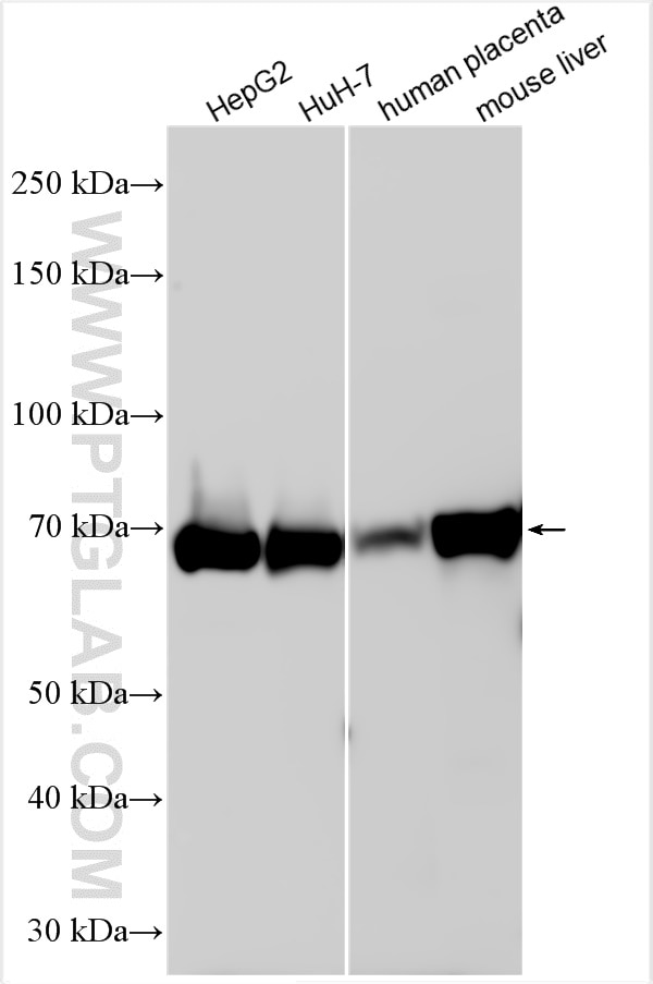 Western Blot (WB) analysis of various lysates using PTPRD Polyclonal antibody (27941-1-AP)