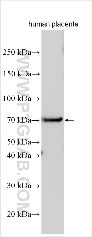 Western Blot (WB) analysis of various lysates using PTPRD Polyclonal antibody (27941-1-AP)