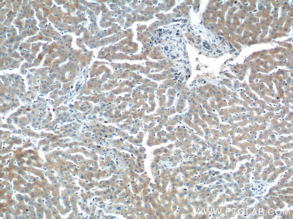 Immunohistochemistry (IHC) staining of human liver tissue using PTPRE Polyclonal antibody (13922-1-AP)