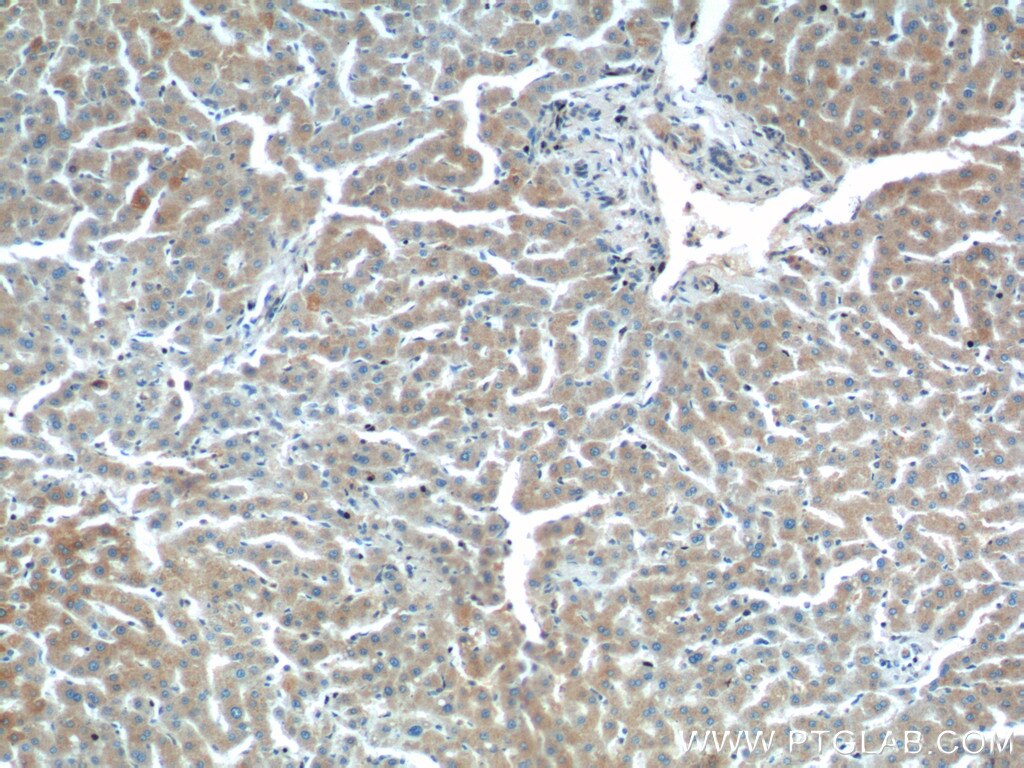 IHC staining of human liver using 13922-1-AP