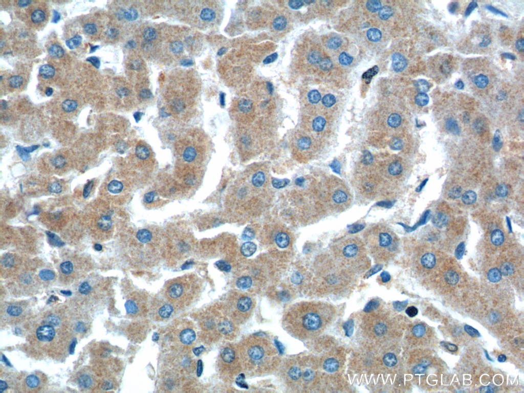 Immunohistochemistry (IHC) staining of human liver tissue using PTPRE Polyclonal antibody (13922-1-AP)