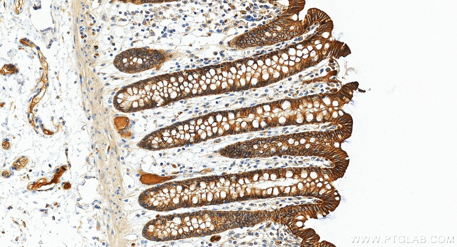 Immunohistochemistry (IHC) staining of human colon tissue using PTPRF Polyclonal antibody (33529-1-AP)
