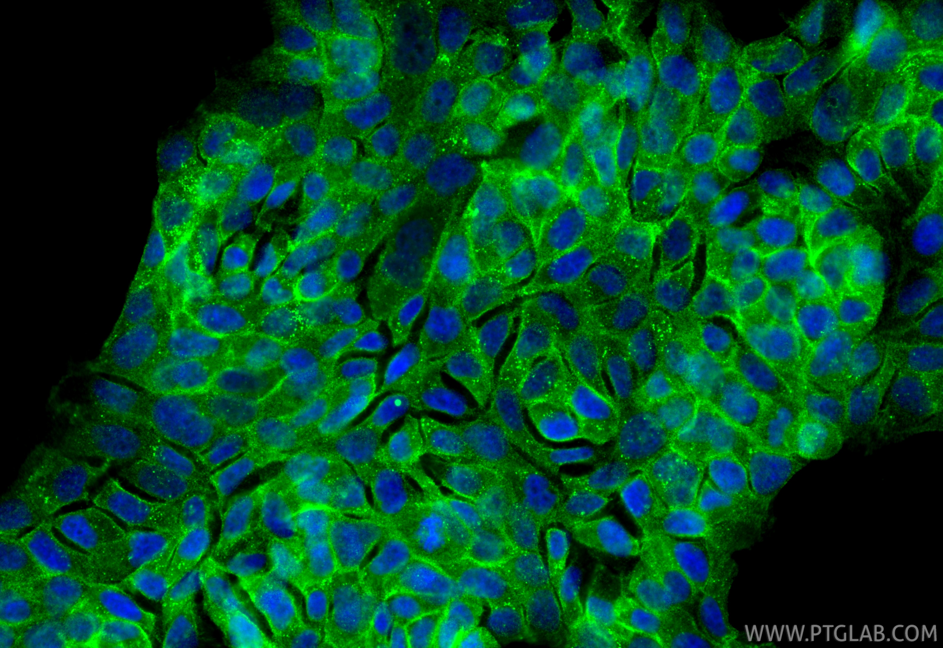 Immunofluorescence (IF) / fluorescent staining of RT-4 cells using PTPRF Polyclonal antibody (33529-1-AP)
