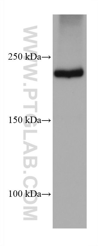 Western Blot (WB) analysis of 4T1 cells using PTPRF Monoclonal antibody (68070-1-Ig)