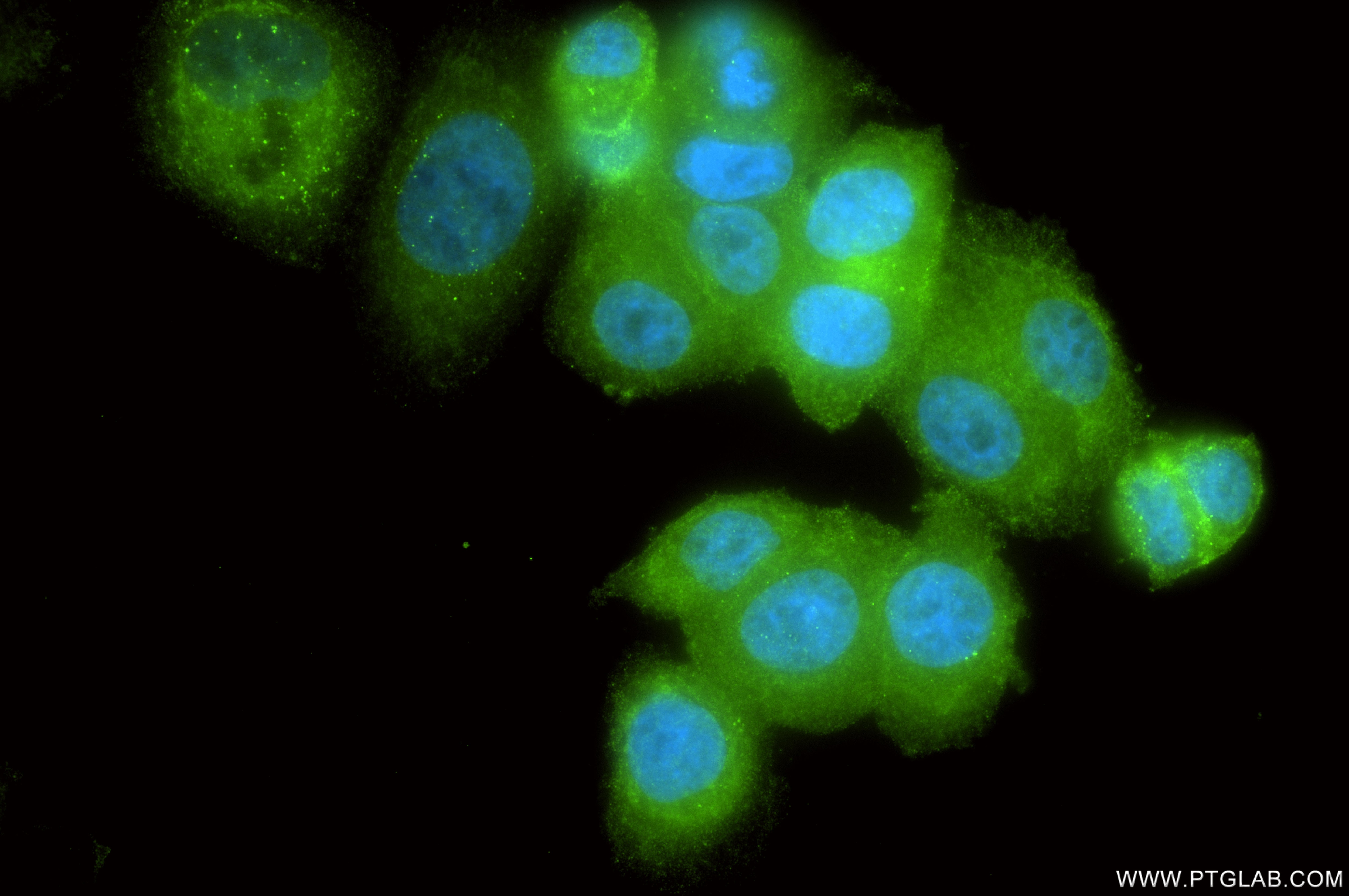 Immunofluorescence (IF) / fluorescent staining of SK-BR-3 cells using PTPRF Recombinant monoclonal antibody (86944-1-RR)