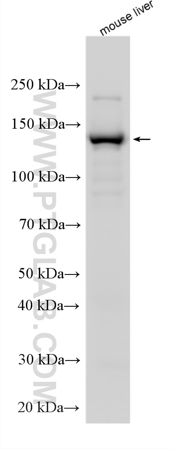 Western Blot (WB) analysis of various lysates using PTPRF Recombinant monoclonal antibody (86944-1-RR)