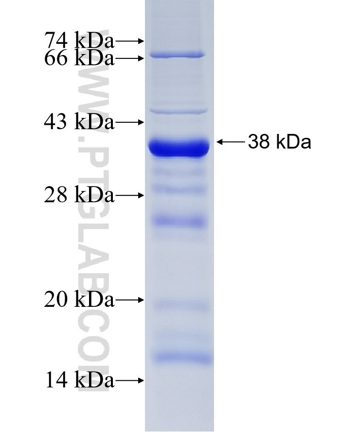 PTPRG fusion protein Ag19410 SDS-PAGE