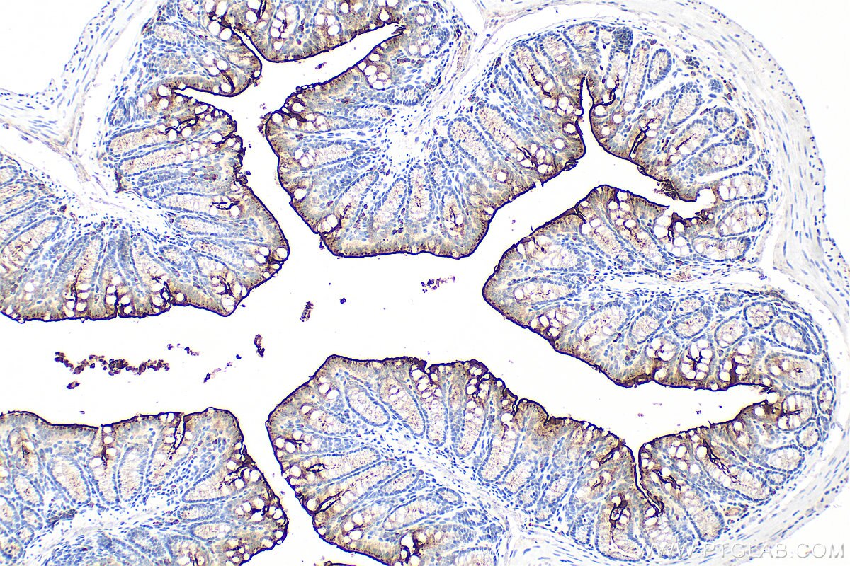 Immunohistochemical analysis of paraffin-embedded mouse colon tissue slide using 33732-1-AP (PTPRH antibody) at dilution of 1:200 (under 10x lens). Heat mediated antigen retrieval with Tris-EDTA buffer (pH 9.0). Immunohistochemistry (IHC) staining of mouse colon tissue using PTPRH Polyclonal antibody (33732-1-AP)