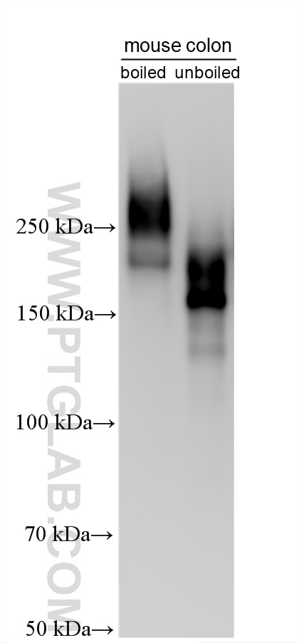 Various lysates were subjected to SDS PAGE followed by western blot with 33732-1-AP (PTPRH antibody) at dilution of 1:10000 incubated at room temperature for 1.5 hours. Western Blot (WB) analysis of various lysates using PTPRH Polyclonal antibody (33732-1-AP)