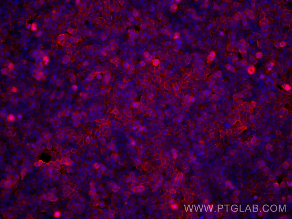 Immunofluorescent analysis of (4% PFA) fixed HT-29 cells using PTPRH antibody (68635-1-Ig, Clone: 3C6E8 ) at dilution of 1:500 and Multi-rAb CoraLite® Plus 594-Goat Anti-Mouse Recombinant Secondary Antibody (H+L) (Cat.NO. RGAM004 ). This data was developed using the same antibody clone with 68635-1-PBS in a different storage buffer formulation. Immunofluorescence (IF) / fluorescent staining of HT-29 cells using PTPRH Monoclonal antibody (68635-1-Ig)