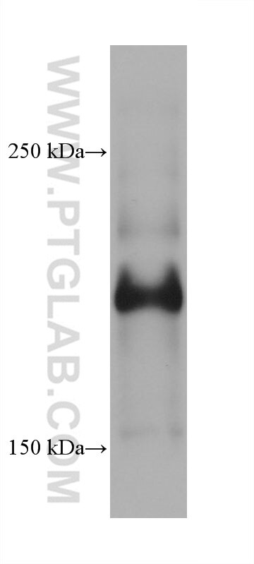 Western Blot (WB) analysis of A431 cells using PTPRH Monoclonal antibody (68635-1-Ig)