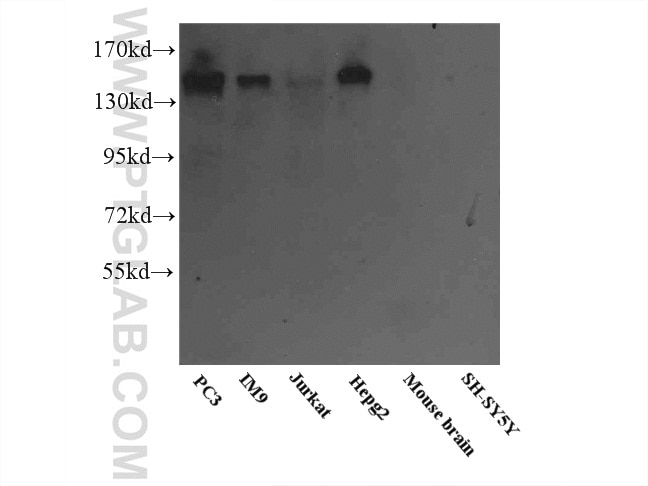 Western Blot (WB) analysis of multi-cells/tissue using PTPRJ Polyclonal antibody (55123-1-AP)