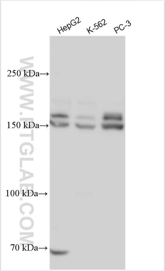 Western Blot (WB) analysis of various lysates using PTPRJ Polyclonal antibody (55123-1-AP)